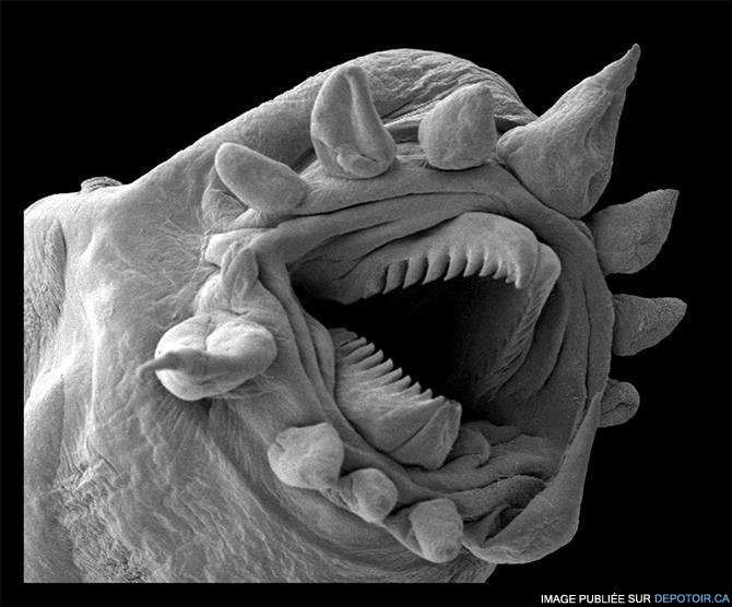 HYDROTHERMAL WORM ELECTRON MICROSCOPE