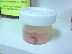 Autre trouvaille gore sur Facebook